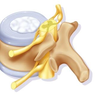 Межпозвонковый диск и нервные корешки